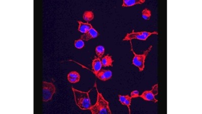 Image of HT-1080 fibrosarcoma cells in which TfR1 is detected with red fluorescence and nuclei are stained blue with DAPI