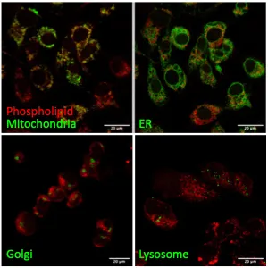 Image of phospholipid in cells