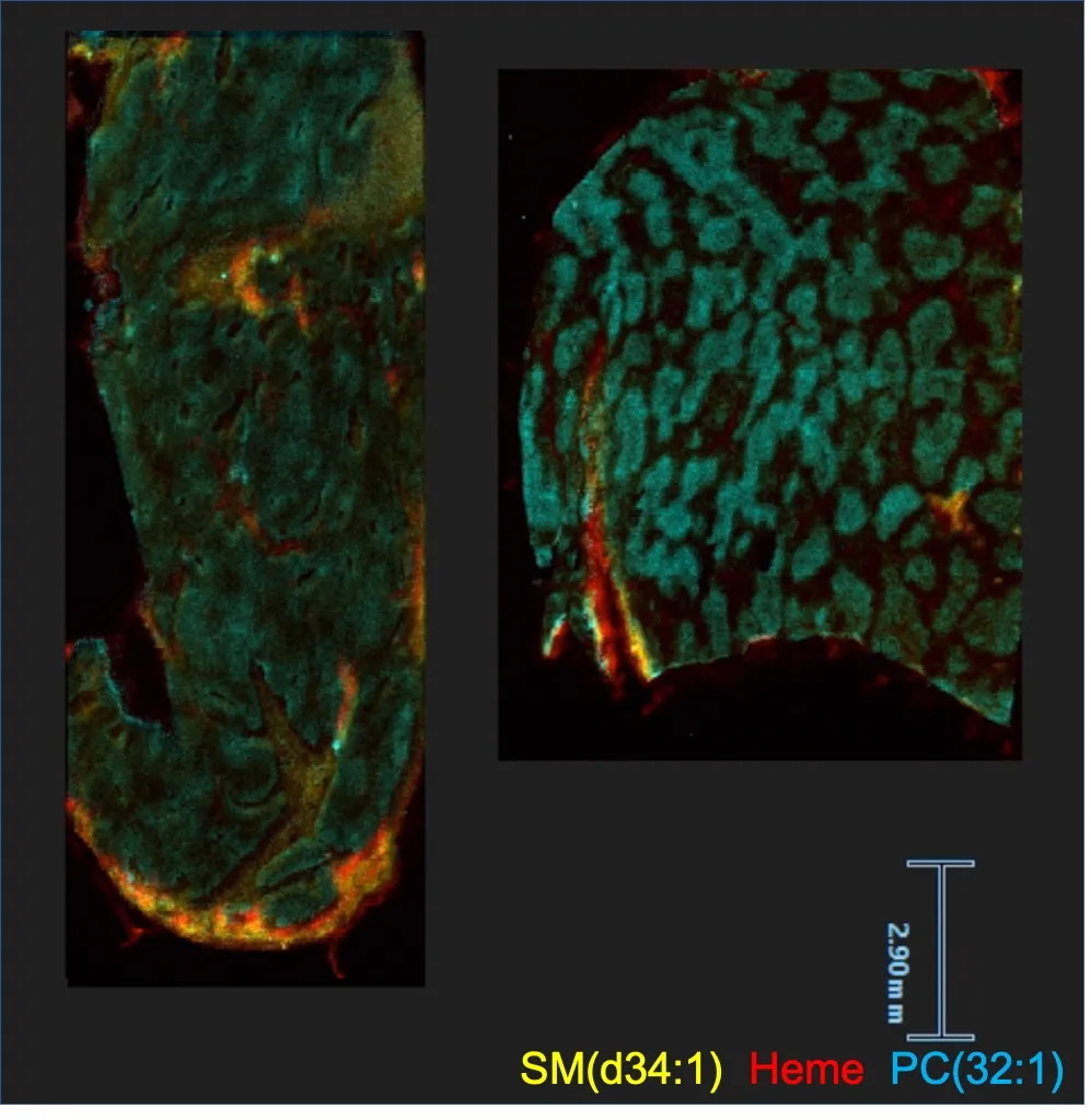 DESI mass spectrometry image of human liver showing tissue architecture and metabolic zonation