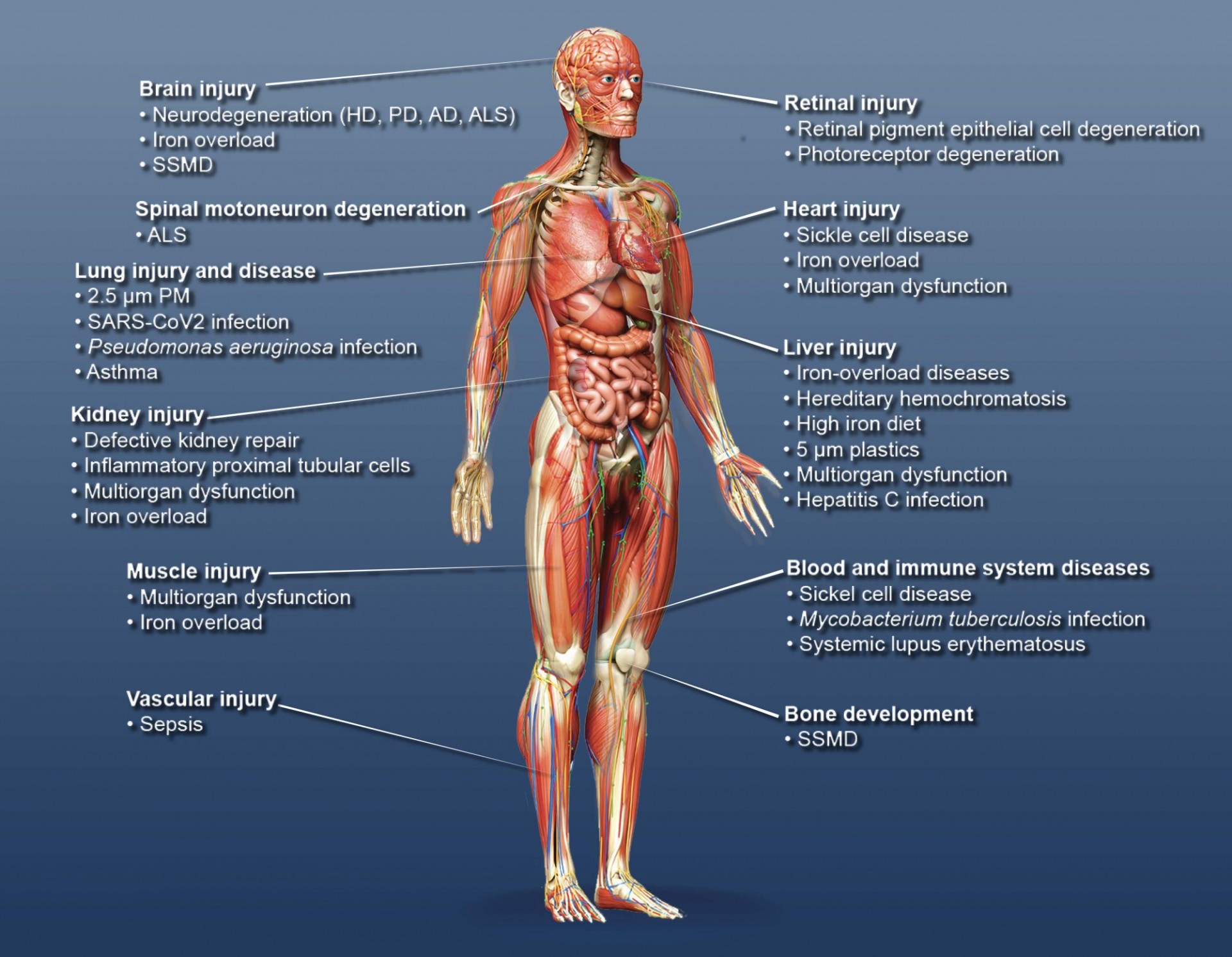 Image of human diseases linked to ferroptosis